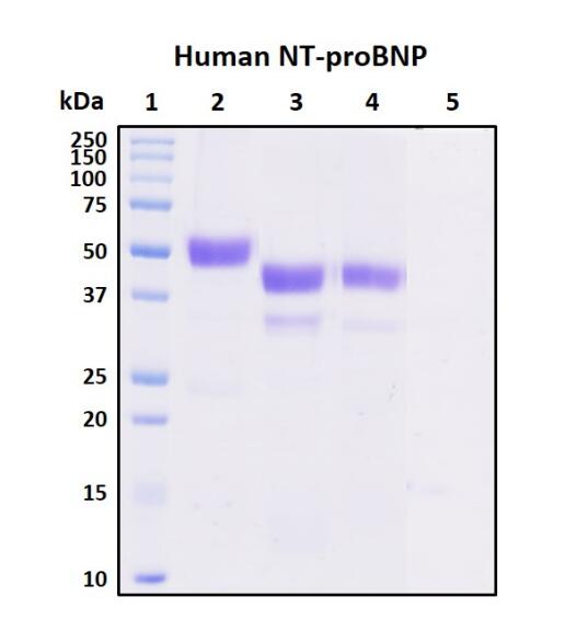 Deglycosylation of purified recombinant proteins. Purified proteins were untreated (Lane 2) or treated with protein deglycosylation enzymes under native (Lane 3) or reducing (Lane 4) conditions. Deglycosylation treatment resulted in a mobility shift of the protein to produce one major band at the expected size, thus indicating that the untreated recombinant protein (Lane 2) was glycosylated.<br />Lane 1: Protein standard ladder (kDa).<br />Lane 2: Untreated protein under reducing conditions.<br />Lane 3: Treated protein with deglycosylation enzymes under native conditions.<br />Lane 4: Treated protein with deglycosylation enzymes under reducing conditions.<br />Lane 5: Deglycosylation mixture only without target proteins.